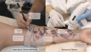 Pete Davidson Shares on “Awful” Tattoo Removal Process:Complete guide to know